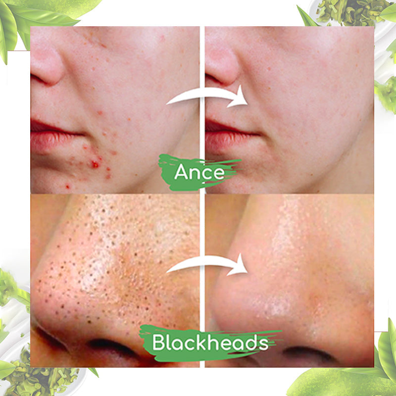 Dobshow™ Green Tea Clay Mask Stick For Oil Control, Blackhead Reduction, and Pore Minimization