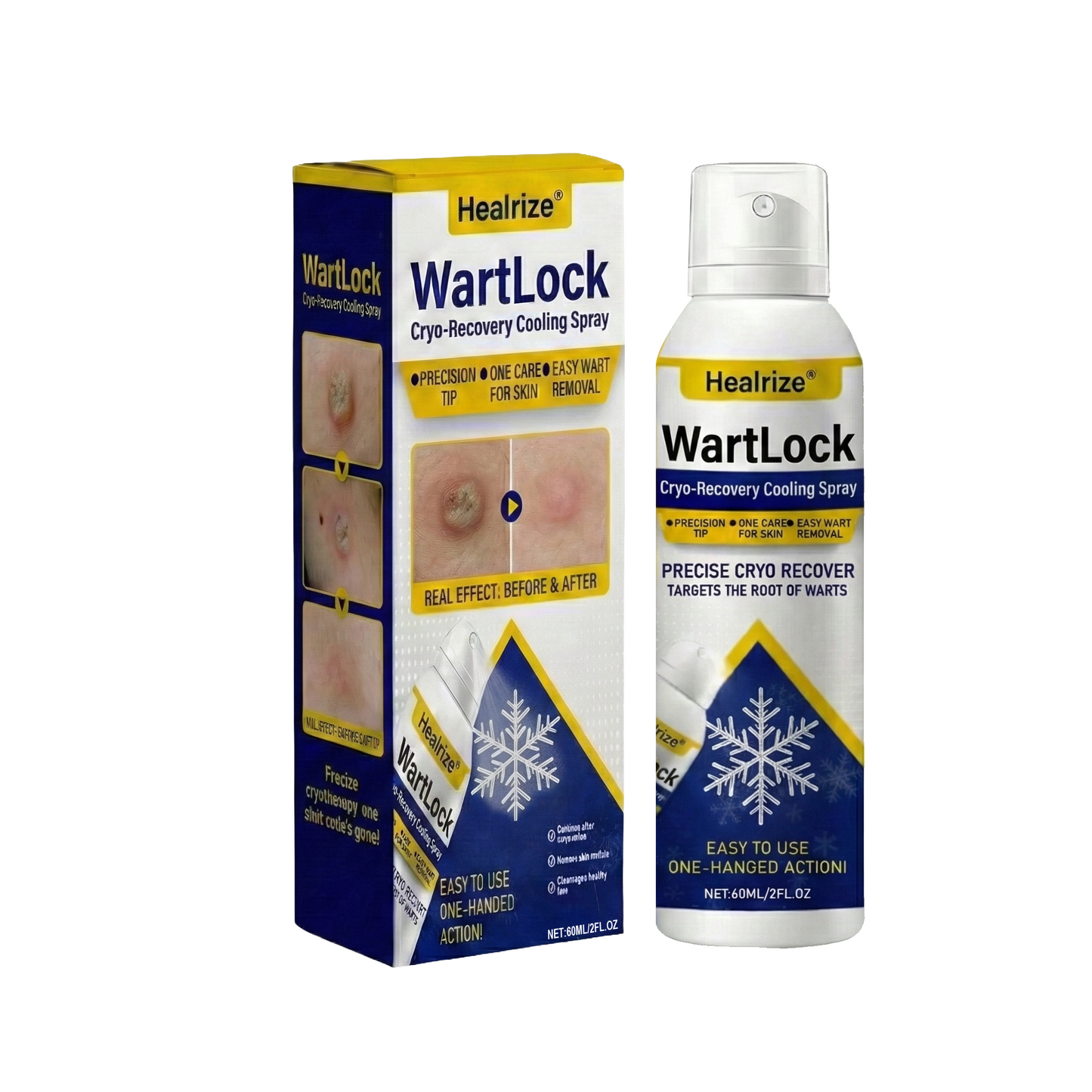๐ฅ๐๐๐ฎ ๐๐ฅ๐๐๐๐๐ก ๐๐๐๐๐ง | Healrizeยฎ WartLock Cryo-Recovery Cooling Spray