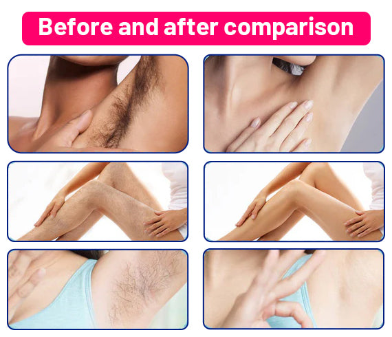 Dobshow™ Hair Removal Spray for Men and Women