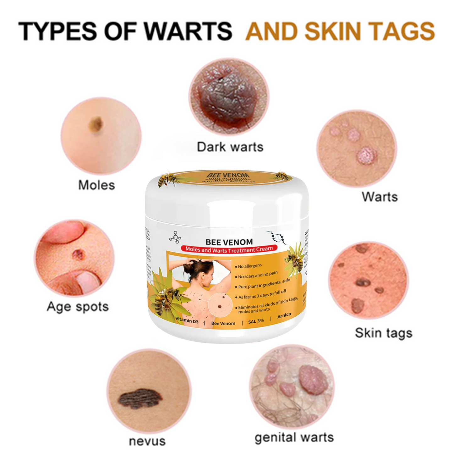 đđ Dobshowâ˘Bee Venom Mole and Wart Treatment Cream
