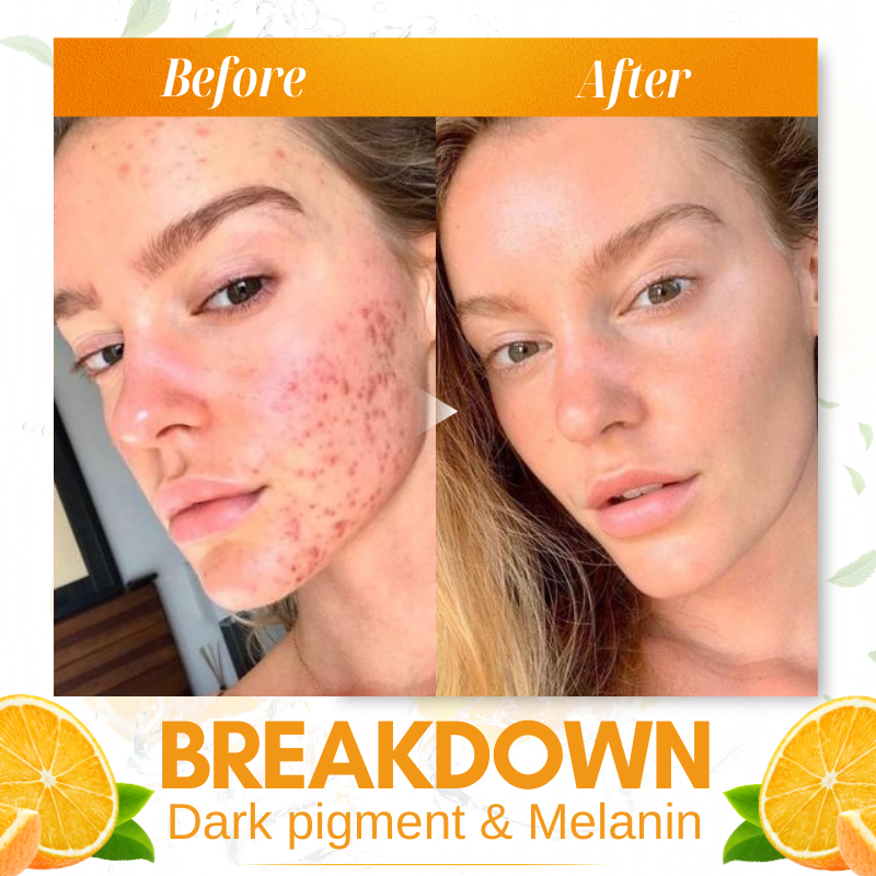 Dobshow™ Whitening Skin Melanin Correcting Facial Serum