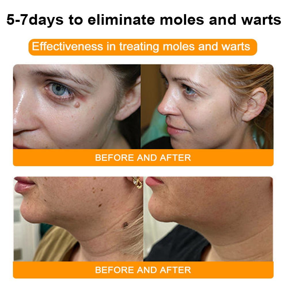 đđ Dobshowâ˘Bee Venom Mole and Wart Treatment Cream