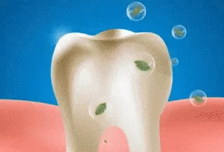 Bright Dentš„Nurbini⢠SP-4 Probiotic Whitening Toothpasteš„