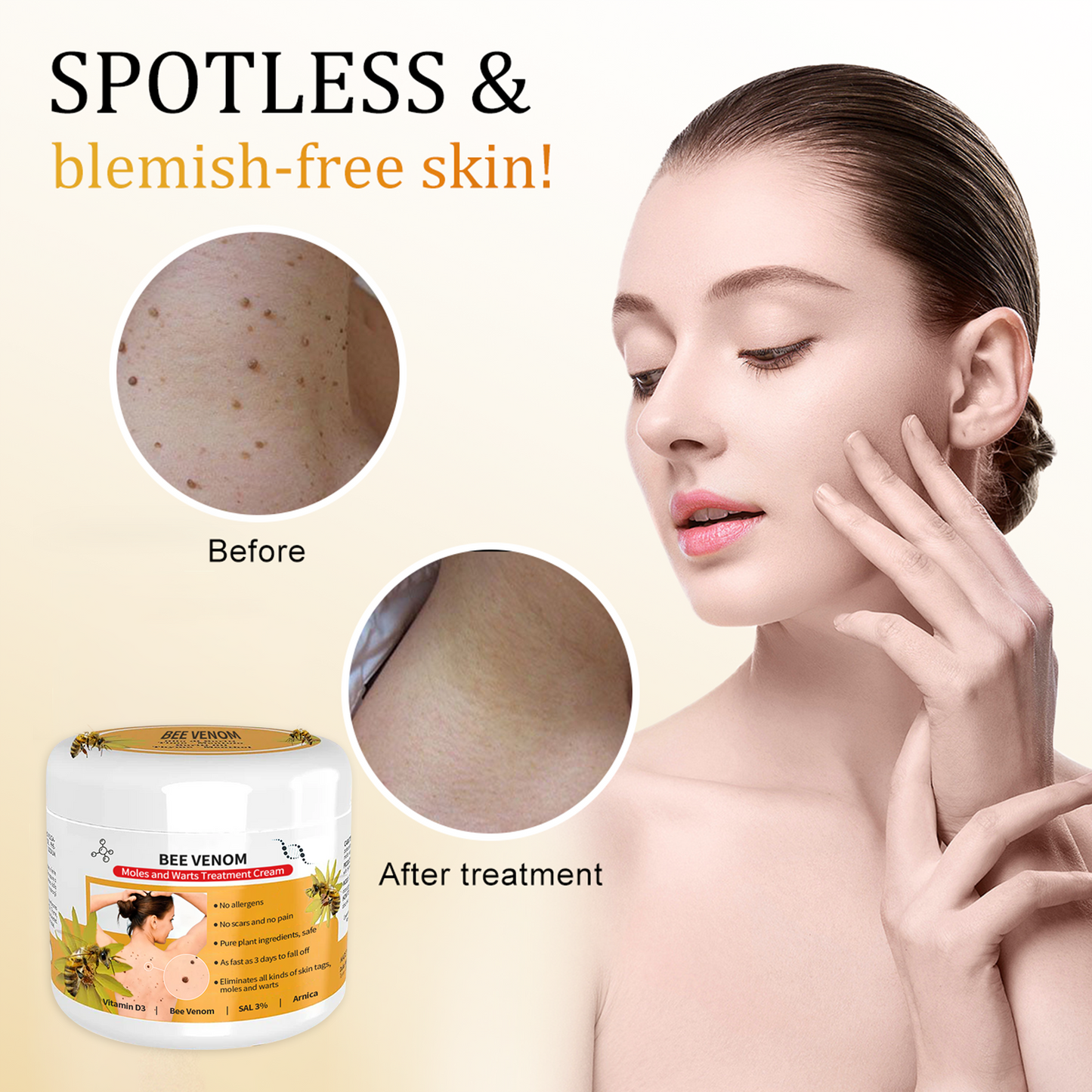 đđ Dobshowâ˘Bee Venom Mole and Wart Treatment Cream