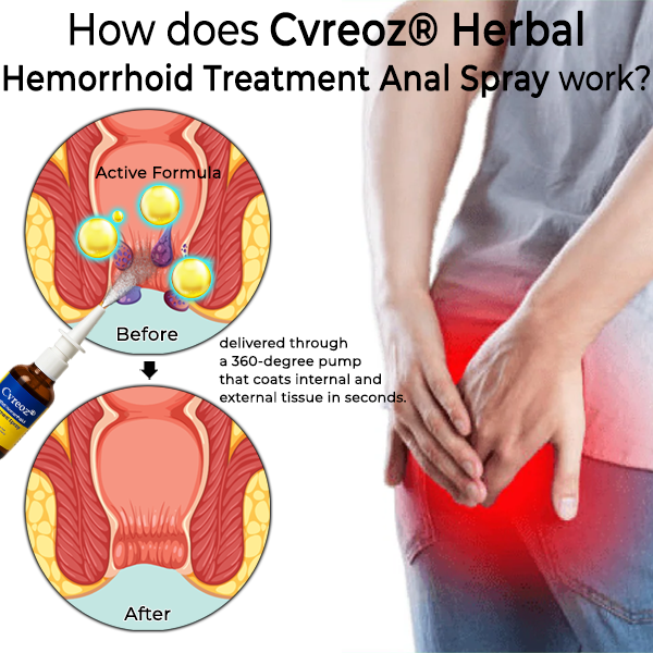 Cvreoz® Herbal Hemorrhoid Treatment Anal Spray Pro