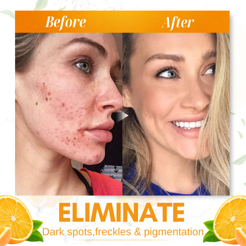 Dobshow™ Whitening Skin Melanin Correcting Facial Serum