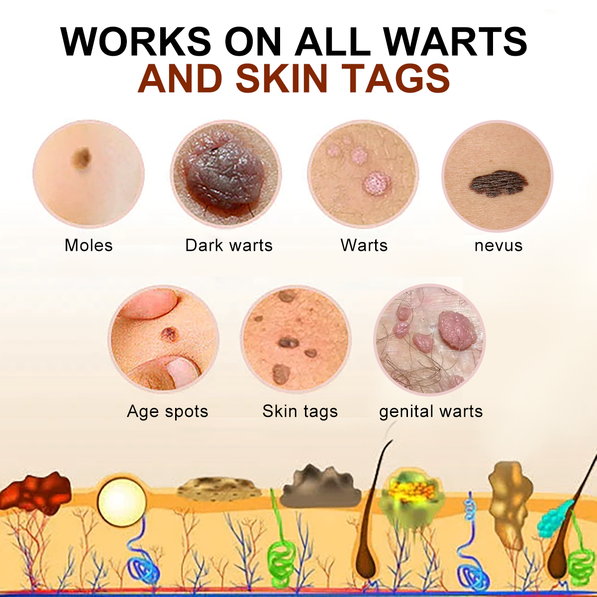 🐝🐝 Dobshow™Bee Venom Mole and Wart Treatment Cream(👨⚕AAD RECOMMENDS)