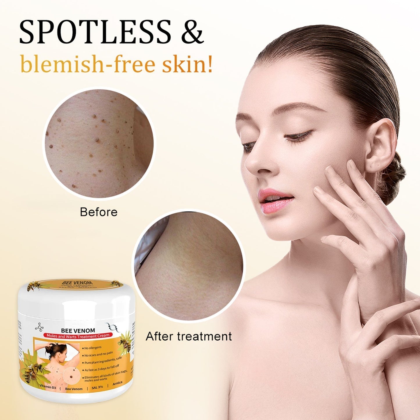 🐝🐝 Dobshow™Bee Venom Mole and Wart Treatment Cream(👨⚕AAD RECOMMENDS)