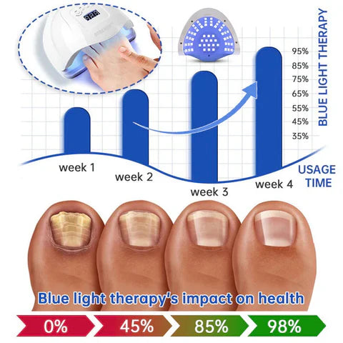 Dobshow™ PureNail Fungus Laser Therapy Device