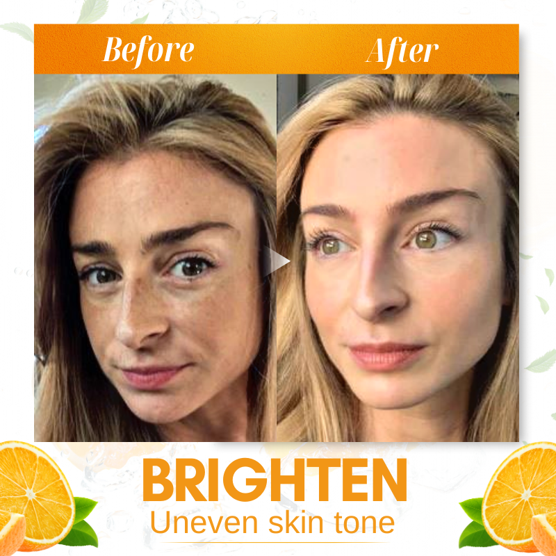 Dobshow™ Whitening Skin Melanin Correcting Facial Serum