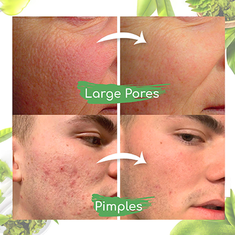 Dobshow™ Green Tea Clay Mask Stick For Oil Control, Blackhead Reduction, and Pore Minimization