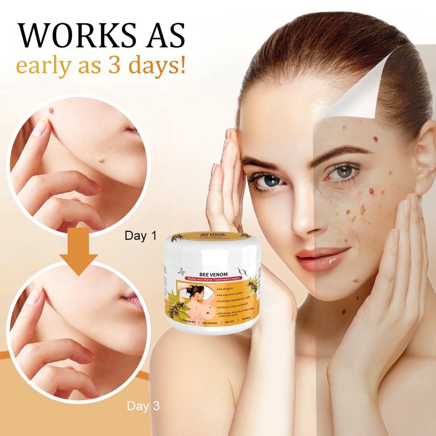 🐝🐝 Dobshow™Bee Venom Mole and Wart Treatment Cream(👨⚕AAD RECOMMENDS)