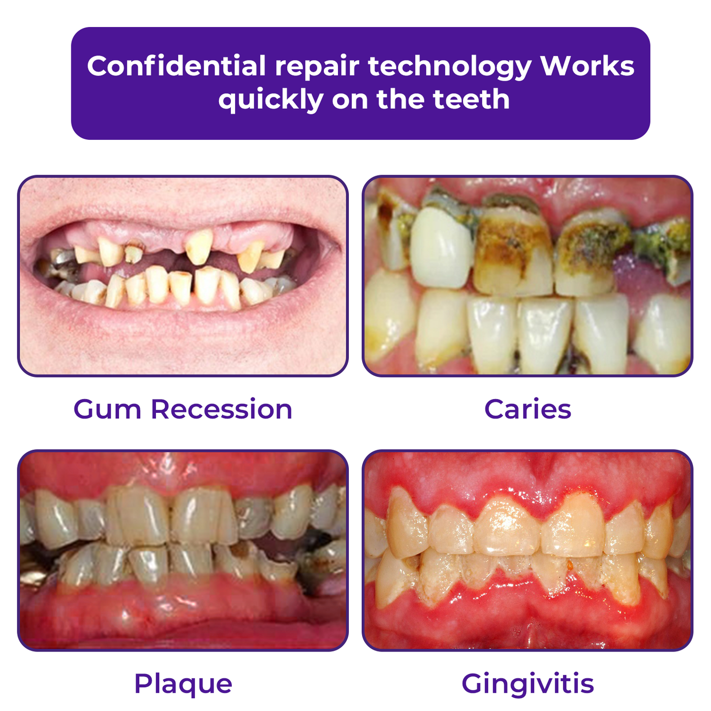š¦·Dobshow⢠Dental Repair Mineral Powder >>š„ 1 + 1 Offerš„