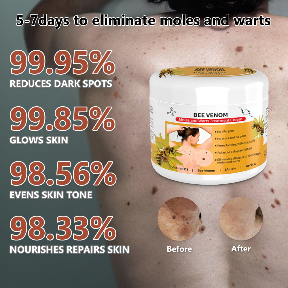 đđ Dobshowâ˘Bee Venom Mole and Wart Treatment Cream