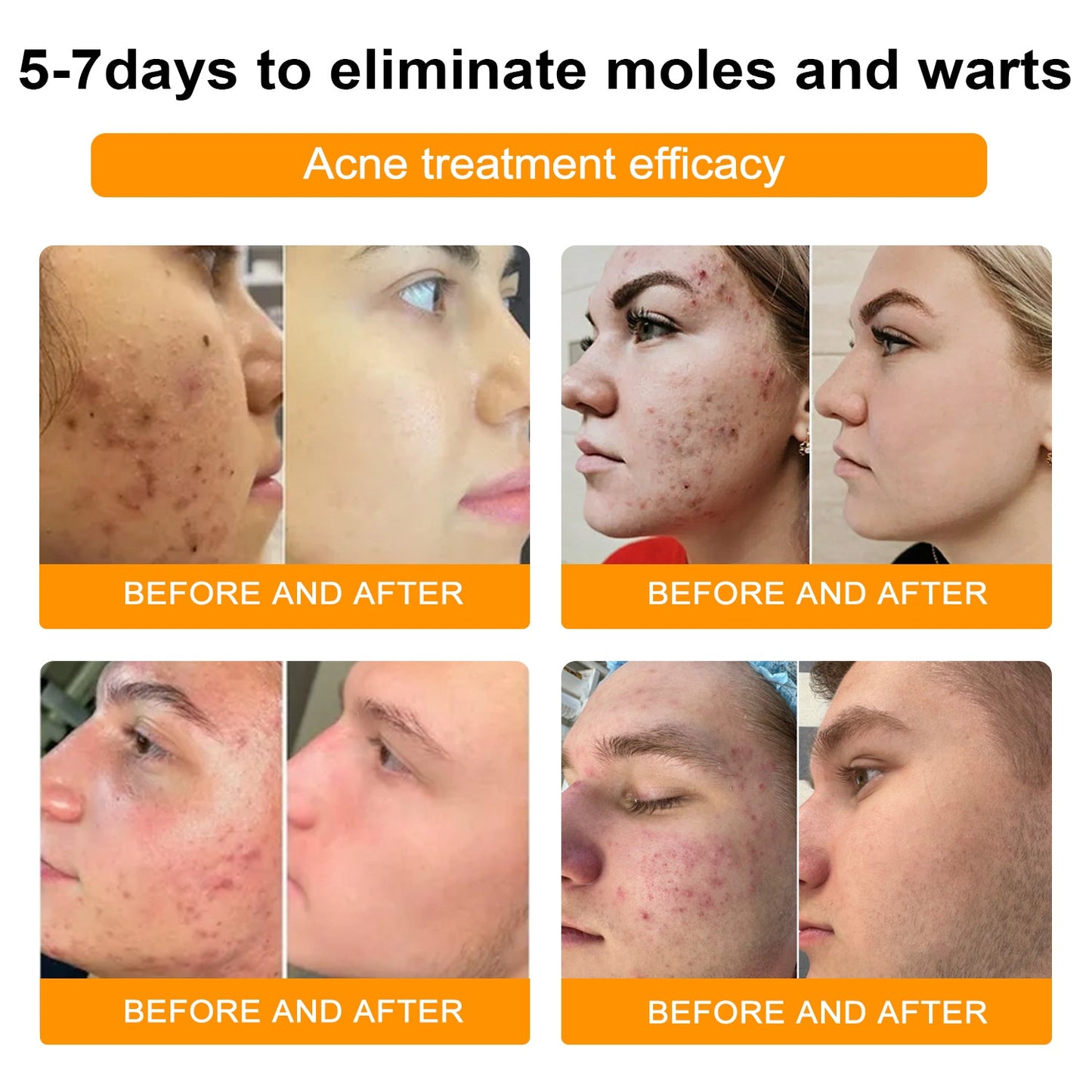 đđ Dobshowâ˘Bee Venom Mole and Wart Treatment Cream