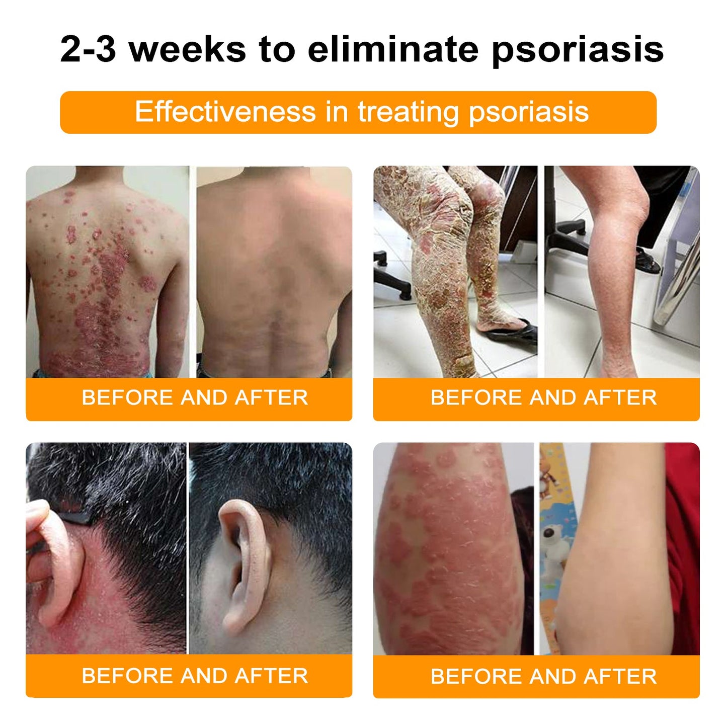 đđ Dobshowâ˘Bee Venom Mole and Wart Treatment Cream