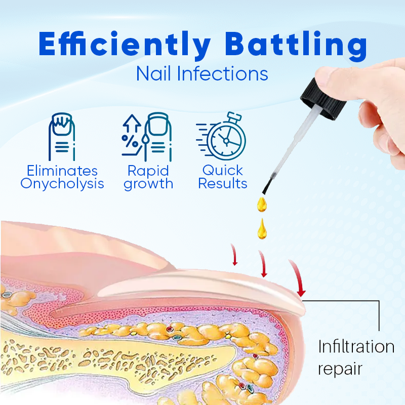 Nurbini™ OnyxoGuard Nail Growth and Repair Serum