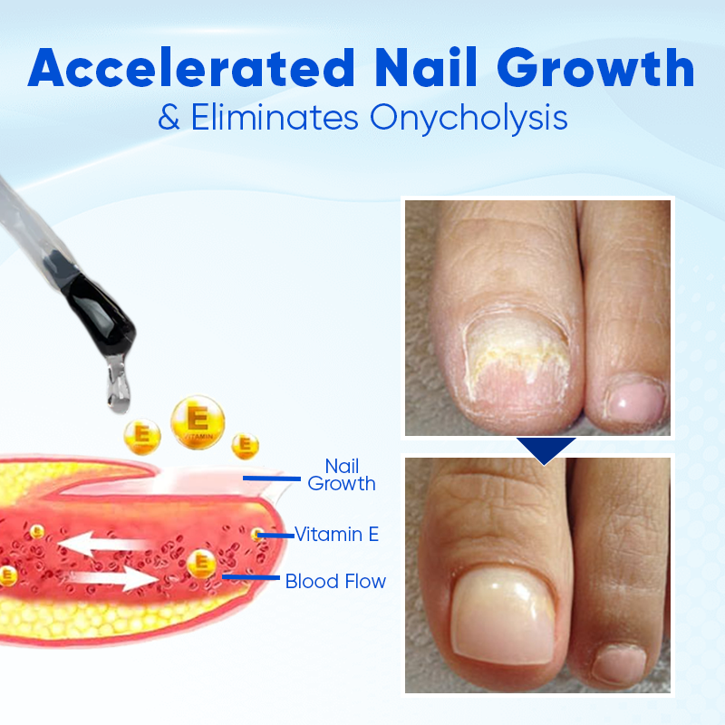 Nurbini™ OnyxoGuard Nail Growth and Repair Serum