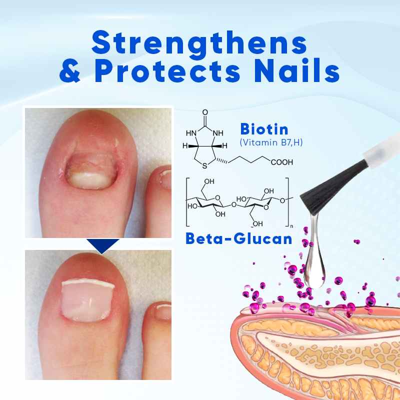 Nurbini™ OnyxoGuard Nail Growth and Repair Serum