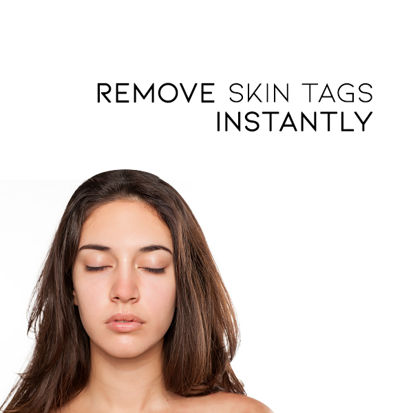 đđ Dobshowâ˘Bee Venom Mole and Wart Treatment Cream