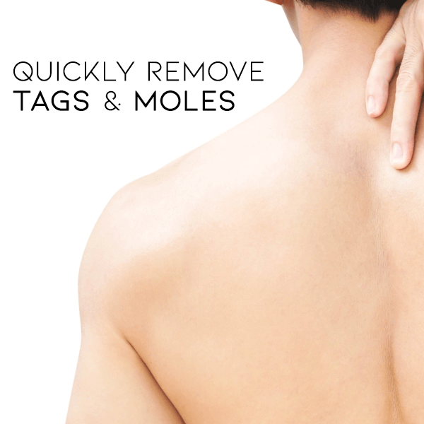 đđ Dobshowâ˘Bee Venom Mole and Wart Treatment Cream