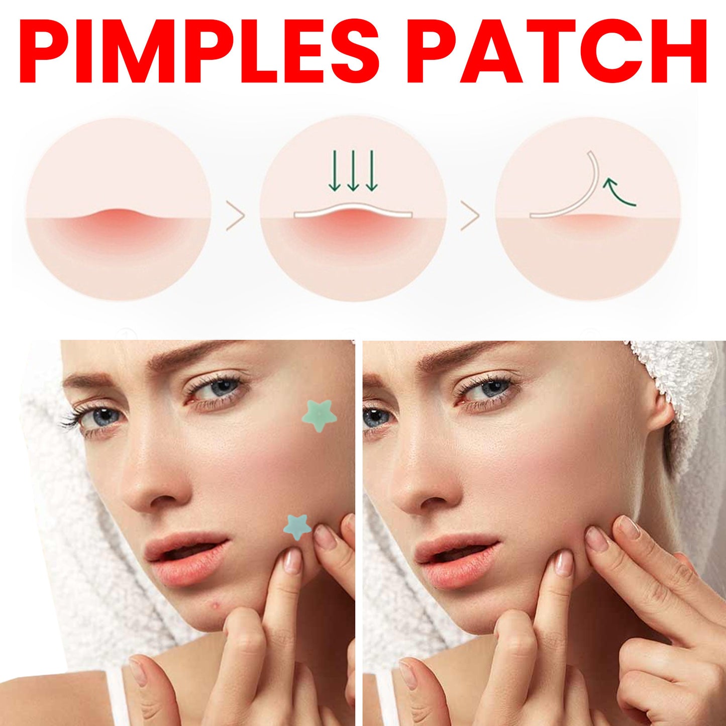 ⭐ Nurbini™ Star pimple patch ⭐