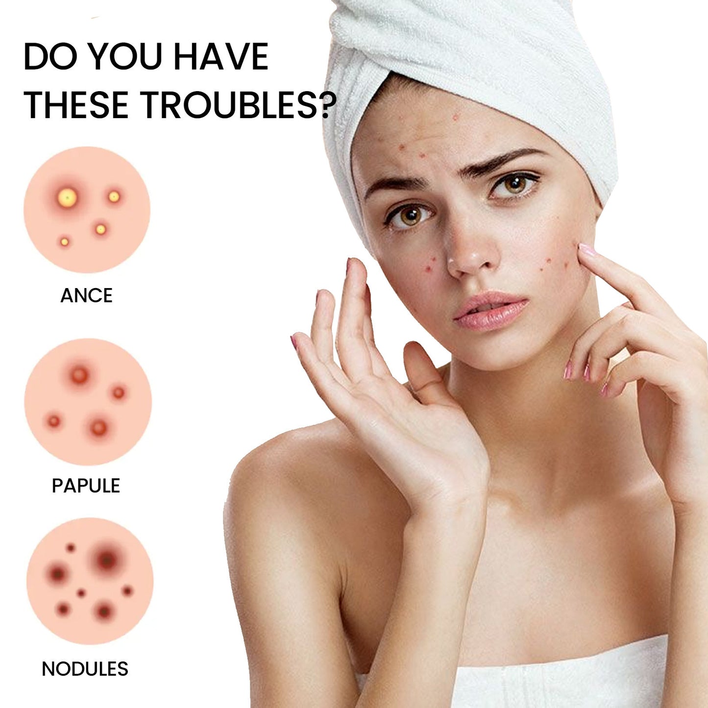 ⭐ Nurbini™ Star pimple patch ⭐