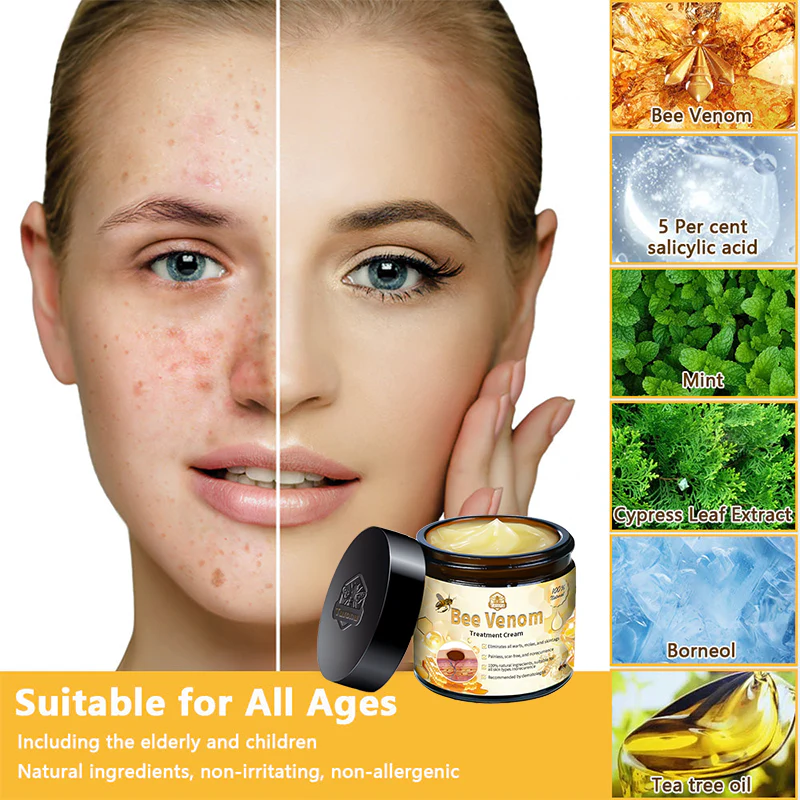 Turonu™ Bee Venom Skin Treatment Cream 🌿 Made in USA