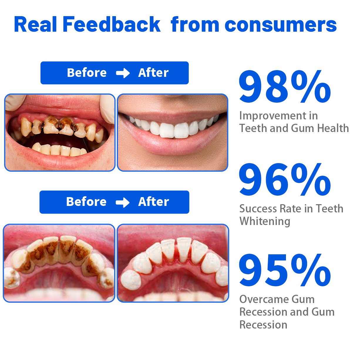 𦷠Dobshow⢠SmartSmile Bee Venom Whitening & Repair Toothpaste