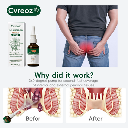 🎄𝙃𝙤𝙡𝙞𝙙𝙖𝙮 𝙎𝙖𝙡𝙚🎁Cvreoz® Fast Hemorrhoid PRO Spray
