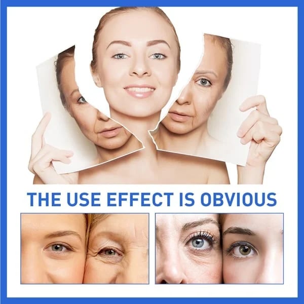 (🔥Last Day Promotion)🔥Nurbini™Luxury Botox Facial- Essence