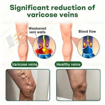 🎁𝙇𝙞𝙢𝙞𝙩𝙚𝙙-𝙩𝙞𝙢𝙚 𝙊𝙛𝙛𝙚𝙧🎁Croaie® VeinLock Microneedle Patch