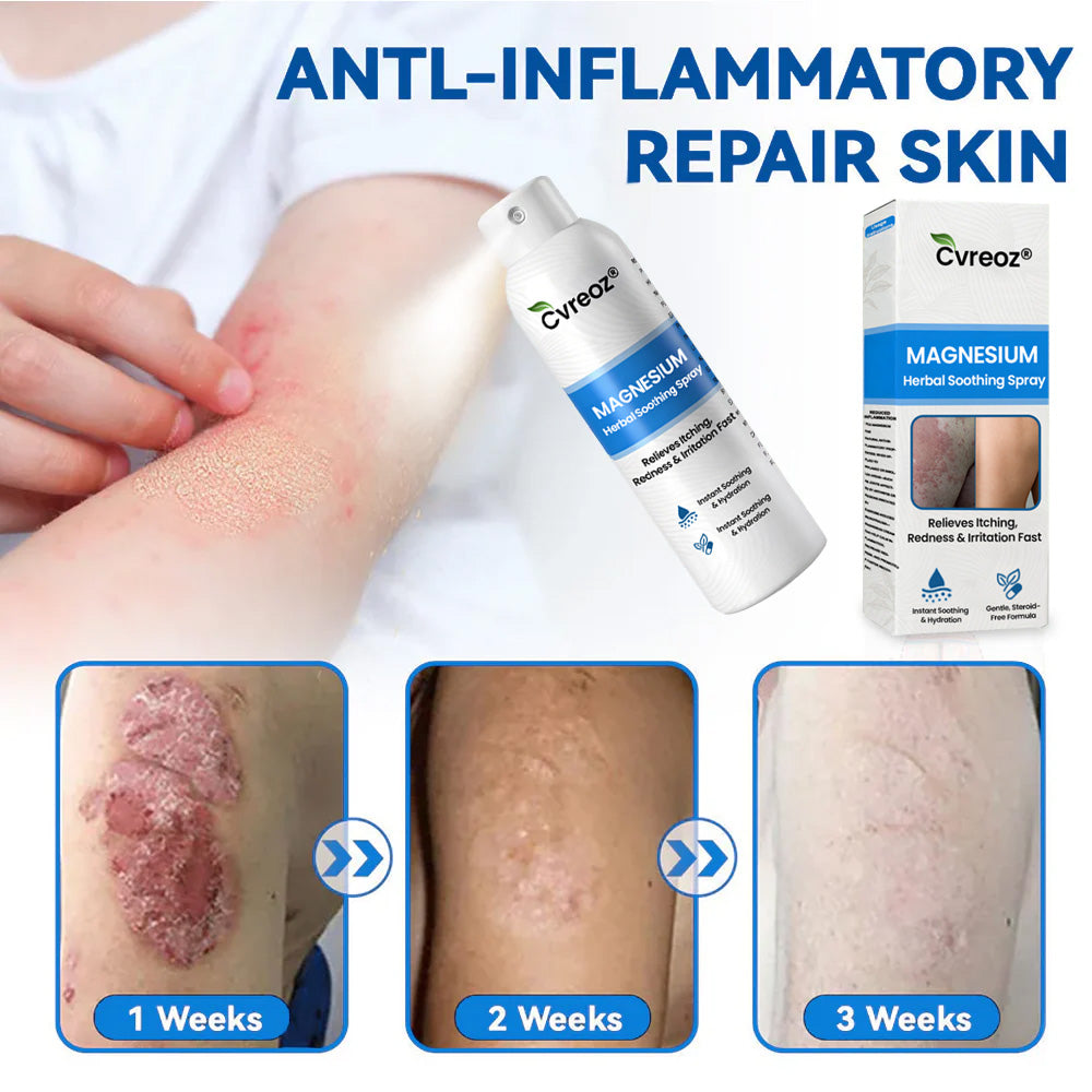🔥𝙁𝙞𝙣𝙖𝙡 3 𝙃𝙤𝙪𝙧𝙨: 80% 𝙊𝙁𝙁: Cvreoz® Magnesium Herbal Psoriasis Spray⚕️ 𝘍𝘋𝘈 𝘊𝘦𝘳𝘵𝘪𝘧𝘪𝘦𝘥 (𝘧𝘰𝘳 𝘵𝘩𝘦 𝘵𝘳𝘦𝘢𝘵𝘮𝘦𝘯𝘵 𝘰𝘧 𝘱𝘴𝘰𝘳𝘪𝘢𝘴𝘪𝘴 𝘢𝘯𝘥 𝘦𝘤𝘻𝘦𝘮𝘢, 𝘪𝘮𝘱𝘳𝘰𝘷𝘦𝘮𝘦𝘯𝘵 𝘰𝘧 𝘣𝘢𝘤𝘵𝘦𝘳𝘪𝘢𝘭 𝘪𝘯𝘧𝘦𝘤𝘵𝘪𝘰𝘯𝘴 𝘪𝘯 𝘵𝘩𝘦 𝘨𝘦𝘯𝘪𝘵𝘢𝘭 𝘢𝘳𝘦𝘢, 𝘵𝘳𝘦𝘢𝘵𝘮𝘦𝘯𝘵 𝘰𝘧 𝘢𝘤𝘯𝘦 𝘢𝘯𝘥 𝘸𝘢𝘳𝘵𝘴, 𝘦𝘭𝘪𝘮𝘪𝘯𝘢𝘵𝘦𝘴 𝘱𝘴𝘰𝘳𝘪𝘢𝘴𝘪𝘴 𝘢𝘯𝘥 𝘦𝘤𝘻𝘦𝘮𝘢, 𝘦𝘵𝘤.)