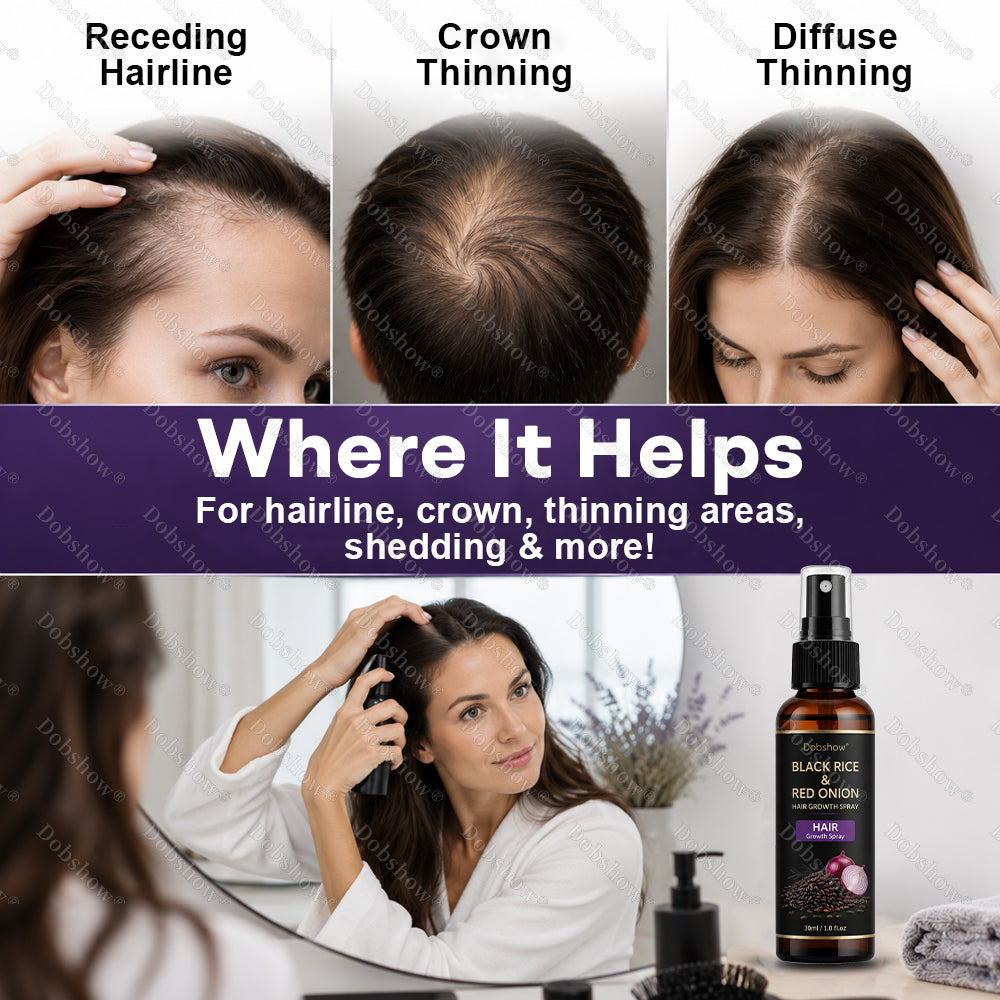 Dobshow® Black Rice & Red Onion Hair Growth Spray