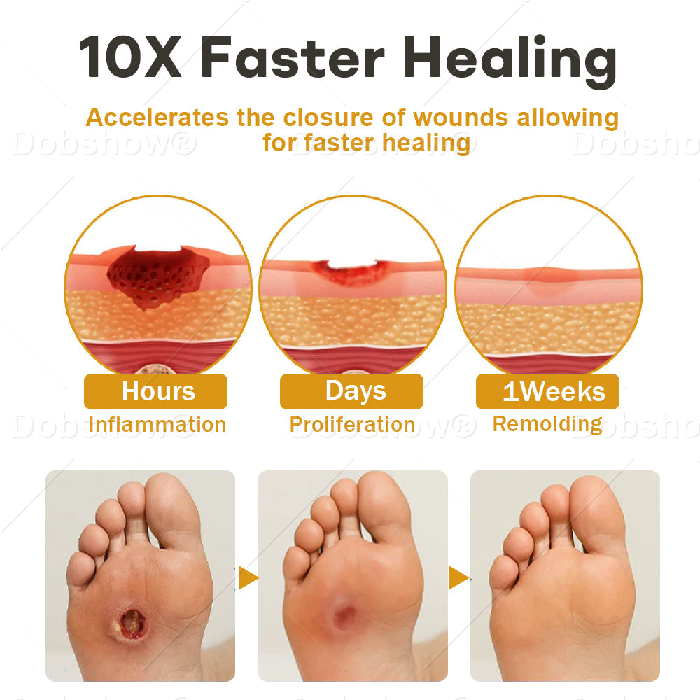 (🔥Last Day Promotion)🔥Healrize® GlucoShield Bee Venom Wound Spray