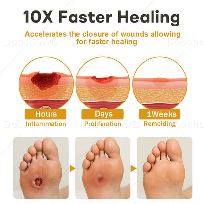 (🔥Last Day Promotion)🔥Healrize® GlucoShield Bee Venom Wound Spray