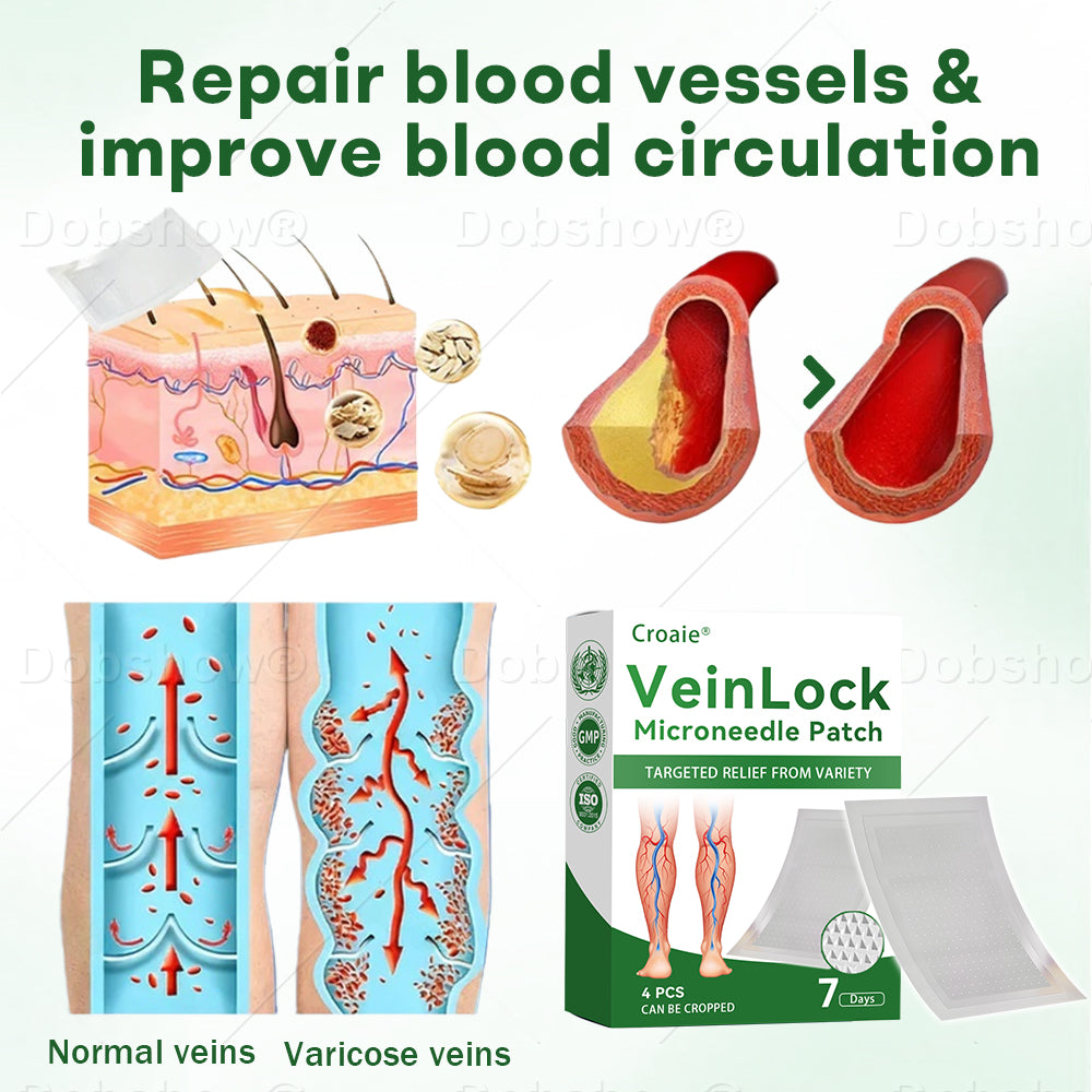 🎁𝙇𝙞𝙢𝙞𝙩𝙚𝙙-𝙩𝙞𝙢𝙚 𝙊𝙛𝙛𝙚𝙧🎁Croaie® VeinLock Microneedle Patch