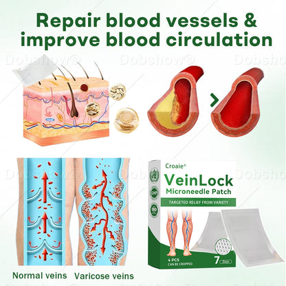 🎁𝙇𝙞𝙢𝙞𝙩𝙚𝙙-𝙩𝙞𝙢𝙚 𝙊𝙛𝙛𝙚𝙧🎁Croaie® VeinLock Microneedle Patch
