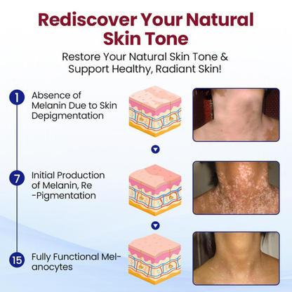 Healrize® Rapid Repair Vitiligo Essence — Visible Results in Weeks, 100% Natural & Steroid-Free