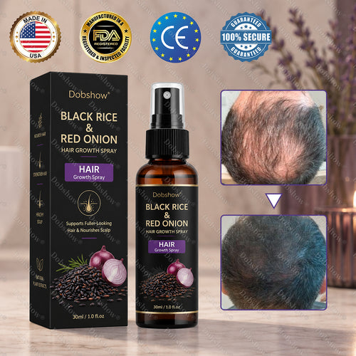 Dobshow® Black Rice & Red Onion Hair Growth Spray