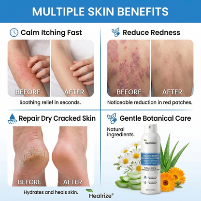 ✨Healrize® Magnesium Botanical Spray – Advanced Skin Recovery for Psoriasis & Eczema | Rapid Soothing, Steroid-Free