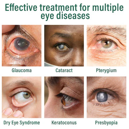 Cvreoz® Nano Eye Drops Serum Pro✅FDA Approved(Suitable for presbyopia, dry eye syndrome, glaucoma, and cataracts)