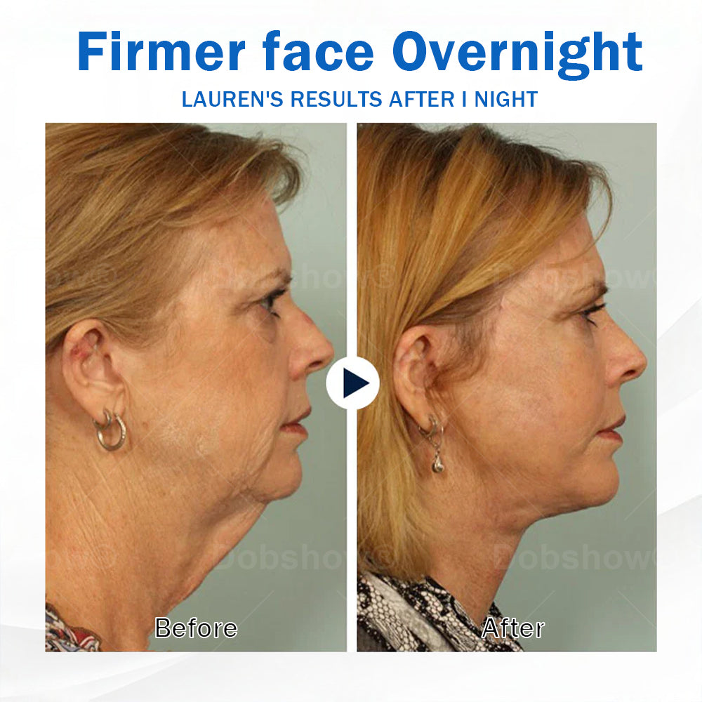 Nurbini® Sleeping V-Face Beauty Device