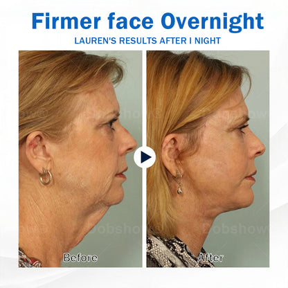 Nurbini® Sleeping V-Face Beauty Device