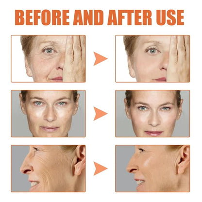 (🔥Last Day Promotion)🔥Nurbini™Luxury Botox Facial- Essence