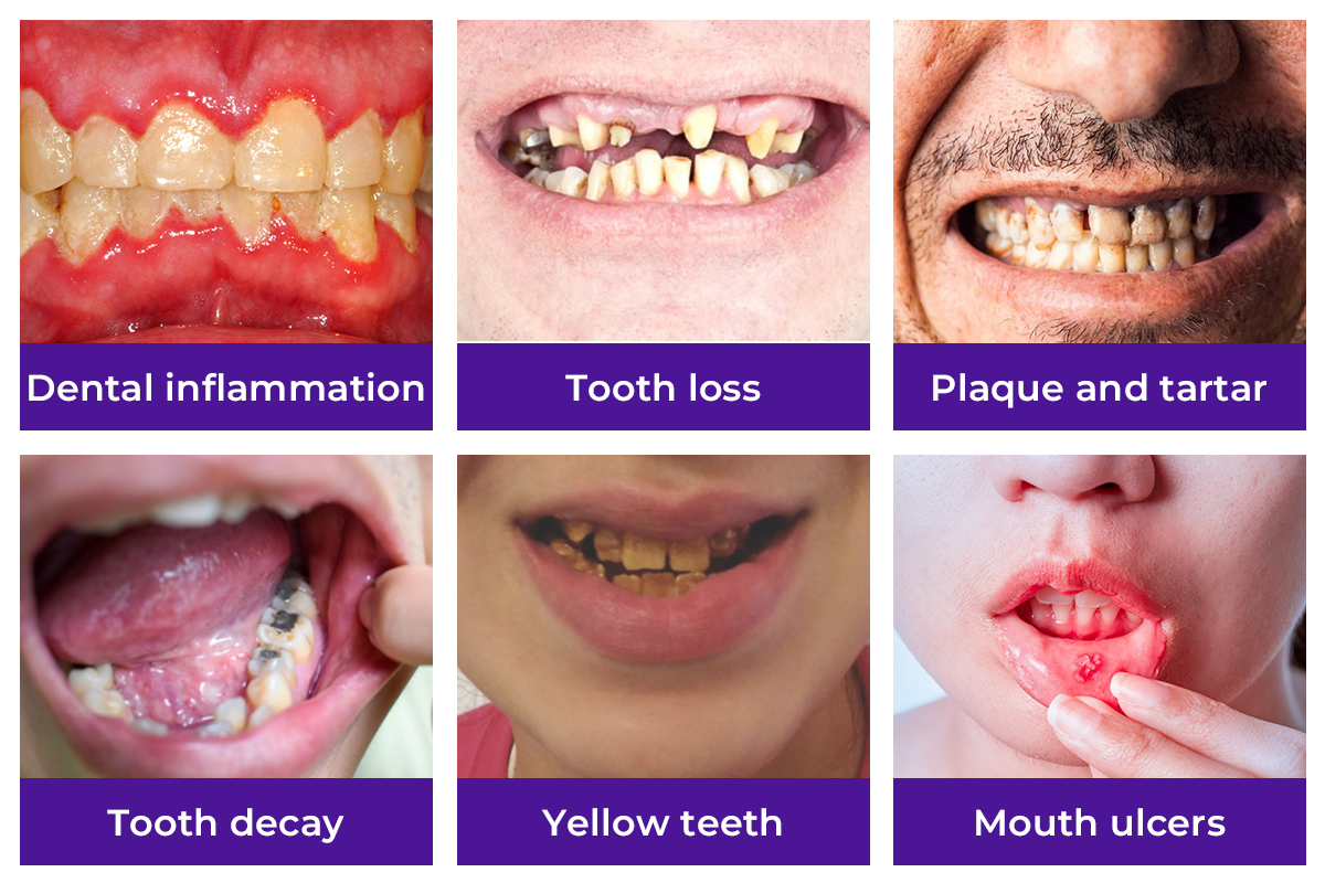 Dobshow® Dental Repair Mineral Powder 16 3 240593fc 1955 4f13 aed9 7930066e6b50
