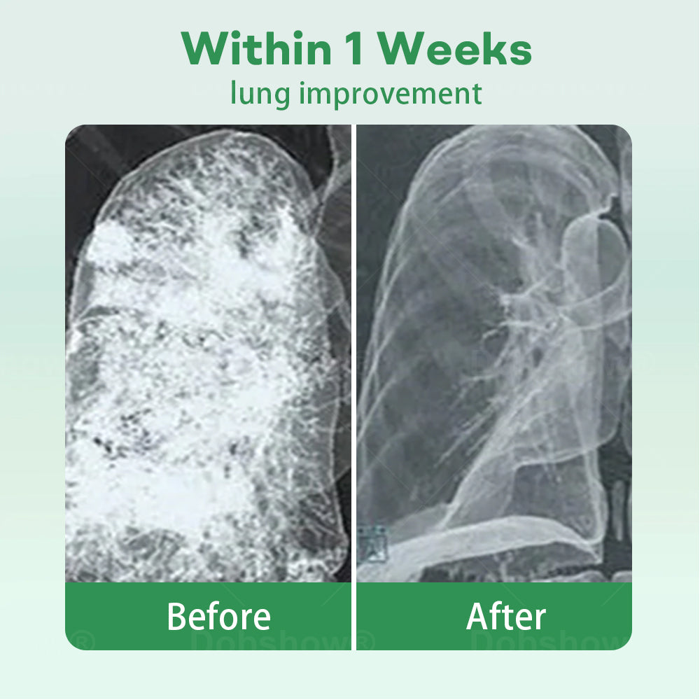 ✅Official Store| 𝐂𝐯𝐫𝐞𝐨𝐳® 𝐇𝐞𝐫𝐛𝐚𝐥 𝐋𝐮𝐧𝐠 𝐂𝐥𝐞𝐚𝐧𝐬𝐢𝐧𝐠 𝐈𝐧𝐡𝐚𝐢𝐞𝐫(🫁Cough, wheezing, shortness of breath, sputum, stuffy nose, bronchitis, bronchitis, allergy symptoms, lung discomfort💝)