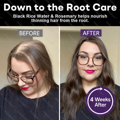 Dobshow® Black Rice & Red Onion Hair Growth Spray