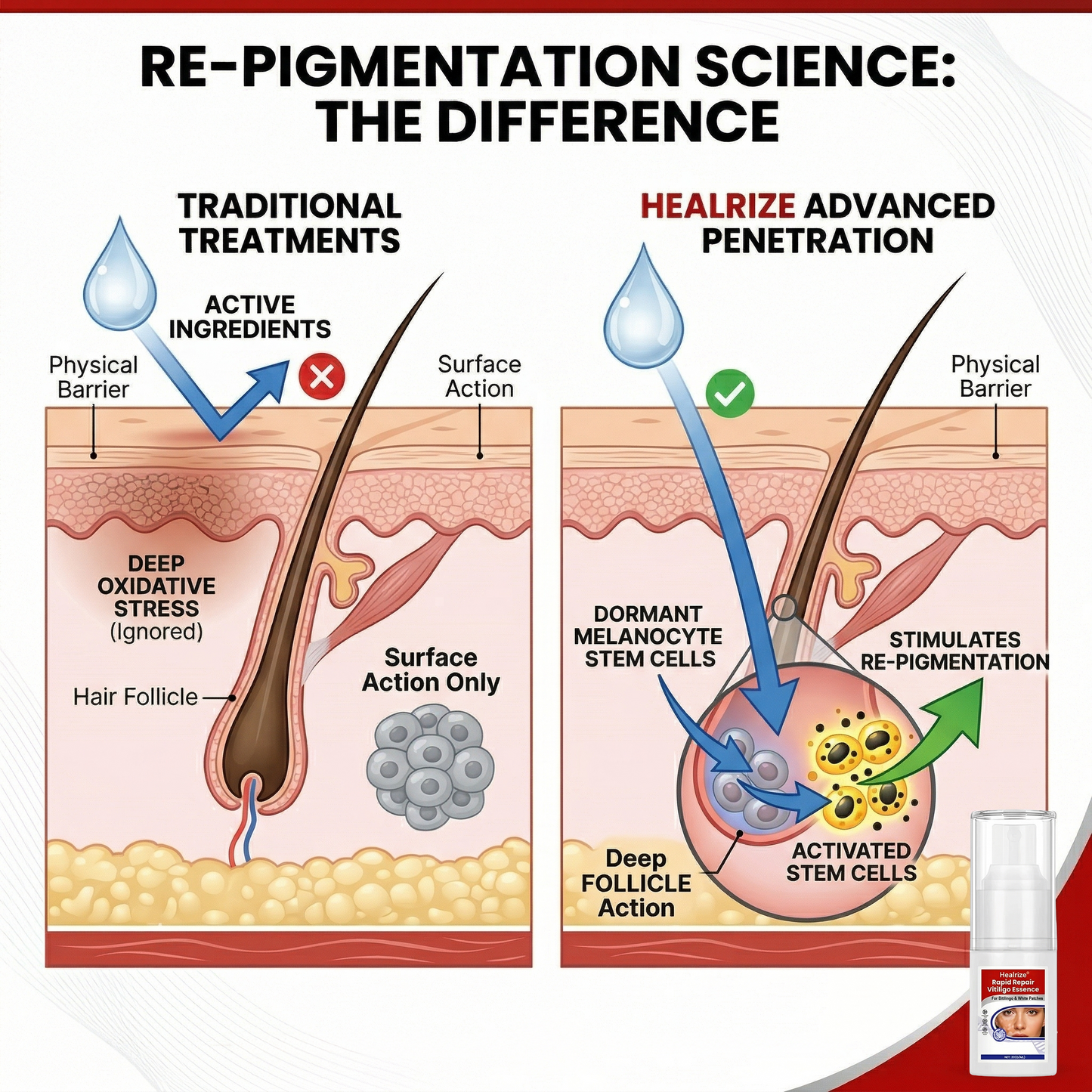 Healrize® Rapid Repair Vitiligo Essence — Visible Results in Weeks, 100% Natural & Steroid-Free