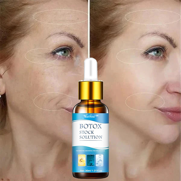 (🔥Last Day Promotion)🔥Nurbini™Luxury Botox Facial- Essence